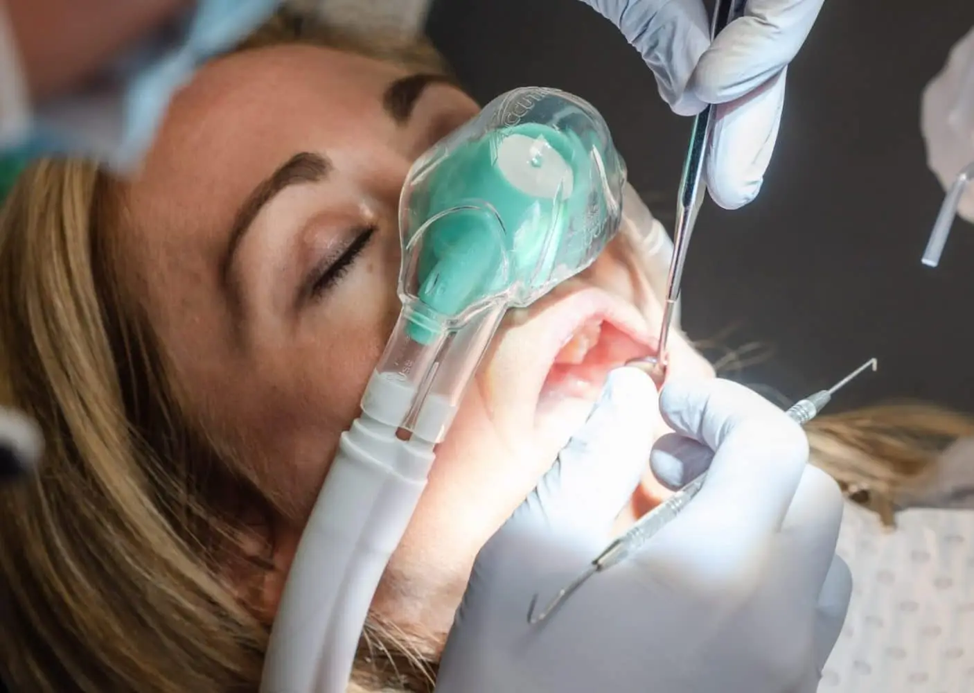 Dental Checkup